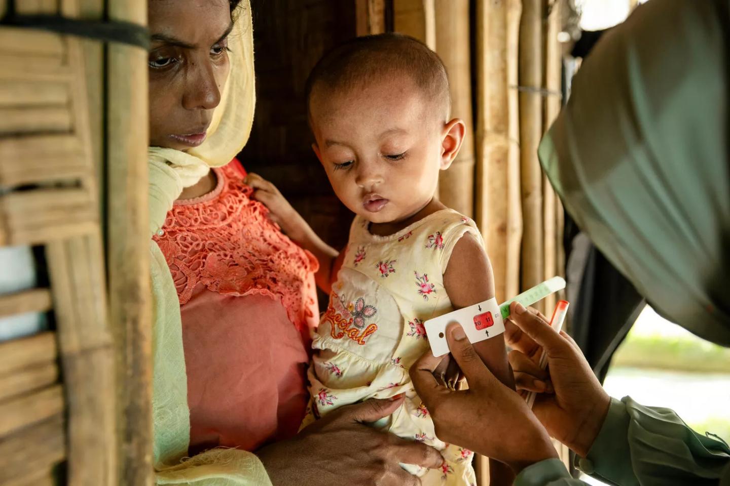 Aid Cuts Drive Rising Child Malnutrition in Rohingya Camps